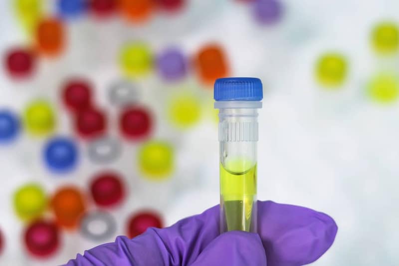 בדיקת PCR – שומרים על הבריאות של כולנו